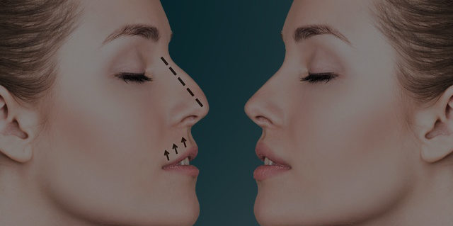 Fasiyal Plastik Fasiyal Plastik
