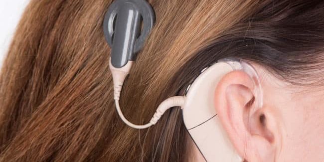 Cochlear Implant Surgery