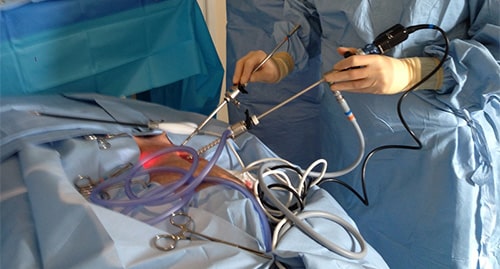 Endoskopik Hipofiz Cerrahisi Endoskopik Hipofiz Cerrahisi