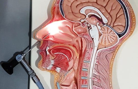 Endoskopik Sinüs Cerrahisi