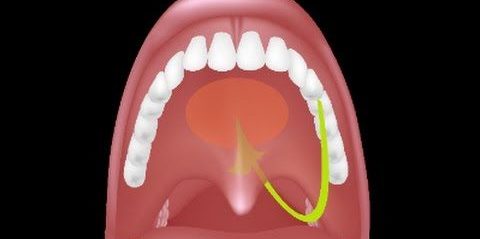 Geniz Eti Ameliyatı