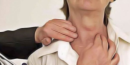 Guatr (Tiroit Bezi Büyümesi)