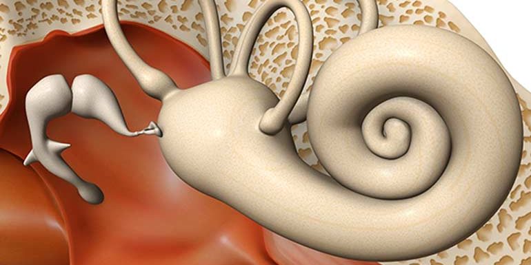 Kulak Kireçlenmesi (Otosleroz)