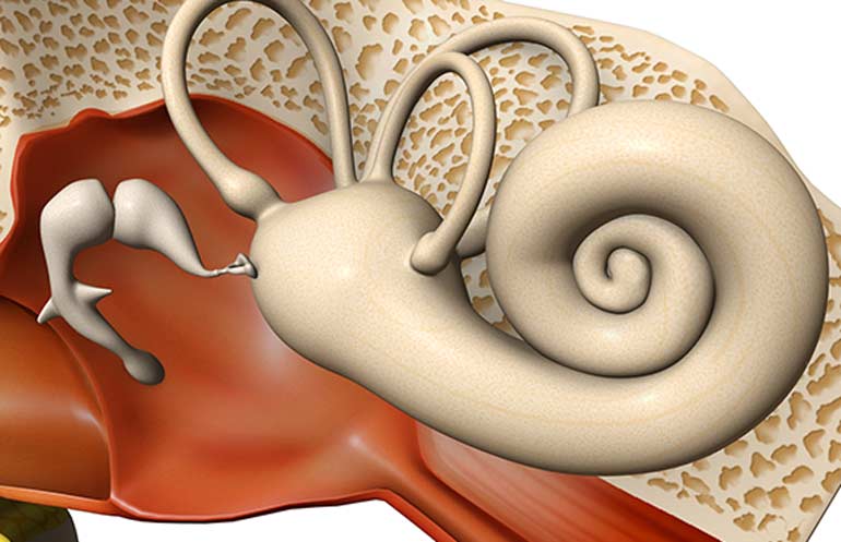 Kulak Kireçlenmesi (Otosleroz)
