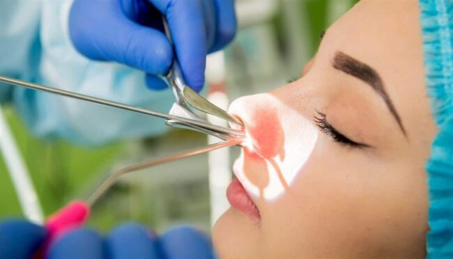 konka-ameliyati Burun Eti (Konka) Ameliyatı Nedir? Nasıl Yapılır?